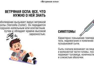 Ветряная оспа